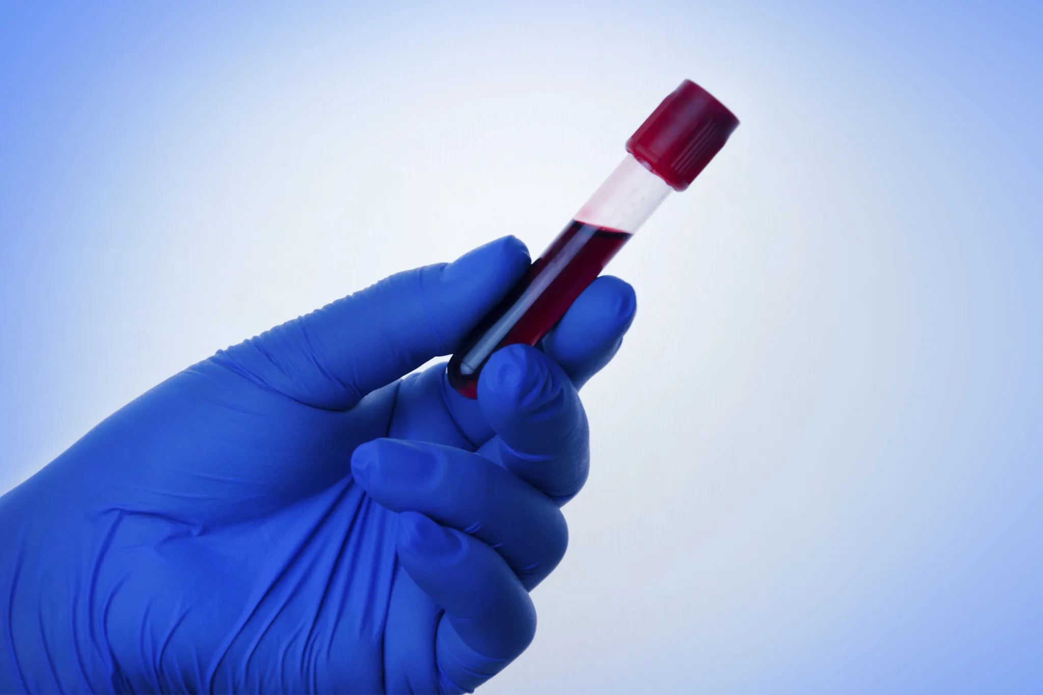 Hand of a doctor holding a bottle of blood.